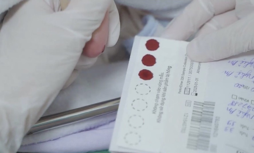 THIẾU HỤT ENZYME BIOTINIDASE !